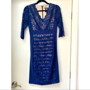 JAX Lace Dress